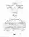 Fig. 07 - ORTHODONTIC BRACKET AND METHOD OF CORRECTING MALPOSITIONED TEETH