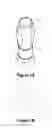 Fig. 02 - Scanbody
