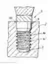 Fig. 01 - METHOD FOR PRODUCING A SURFACE STRUCTURE ON AN IMPLANT, AND SUCH AN IMPLANT