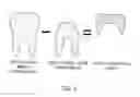 Fig. 04 - APPARATUS AND METHOD FOR CREATING AND MANAGING TEETH MODEL