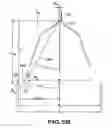 Fig. 08 - Removable embolus blood clot filter