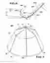 Fig. 10 - Removable embolus blood clot filter