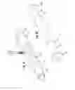 Fig. 17 - Methods of making a prosthesis with a smooth covering