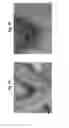 Fig. 31 - Methods of making a prosthesis with a smooth covering