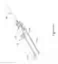 Fig. 13 - Valve delivery system with pinless release mechanism