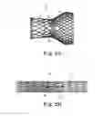 Fig. 04 - Transcatheter prosthetic heart valve delivery system and method with expandable stability tube