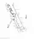 Fig. 06 - Transcatheter prosthetic heart valve delivery system and method with expandable stability tube