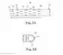 Fig. 07 - Transcatheter prosthetic heart valve delivery system and method with expandable stability tube