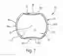 Fig. 07 - Pump bulb for an implantable penile prosthetic