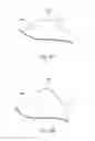 Fig. 09 - Pump bulb for an implantable penile prosthetic
