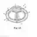 Fig. 04 - Method of providing a patient with an implanted penile prosthetic adapted to provide improved flow of blood to a glans penis