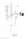 Fig. 14 - Method of providing a patient with an implanted penile prosthetic adapted to provide improved flow of blood to a glans penis