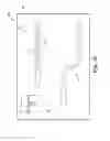 Fig. 15 - Method of providing a patient with an implanted penile prosthetic adapted to provide improved flow of blood to a glans penis