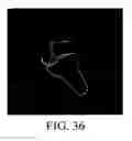 Fig. 33 - Method of generating a patient-specific bone shell