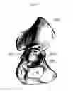 Fig. 10 - Customized surgical guides, methods for manufacturing and uses thereof
