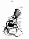 Fig. 12 - Customized surgical guides, methods for manufacturing and uses thereof