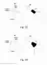 Fig. 40 - Methods for maintaining proper mechanics THA
