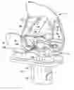 Fig. 01 - Knee joint endoprosthesis