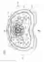 Fig. 08 - Knee joint endoprosthesis