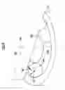 Fig. 09 - Knee joint endoprosthesis