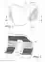 Fig. 02 - FEMORAL COMPONENT FOR KNEE PROSTHESES