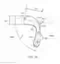 Fig. 06 - Method and apparatus for altering biomechanics of the shoulder
