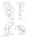 Fig. 07 - Method and apparatus for altering biomechanics of the shoulder