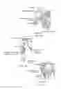 Fig. 08 - Method and apparatus for altering biomechanics of the shoulder