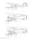 Fig. 02 - ALIGNABLE COUPLING ASSEMBLY FOR CONNECTING TWO PROSTHETIC LIMB COMPONENTS