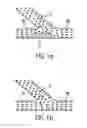 Fig. 02 - METHOD AND APPARATUS FOR STENTING