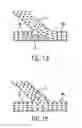 Fig. 02 - METHOD AND APPARATUS FOR STENTING