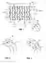 Fig. 02 - DEVICES AND METHODS FOR TREATMENT OF THE EUSTACHIAN TUBE AND SINUS CAVITY