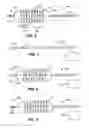 Fig. 04 - DEVICES AND METHODS FOR TREATMENT OF THE EUSTACHIAN TUBE AND SINUS CAVITY