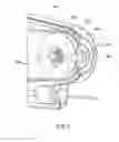 Fig. 06 - Delivery system having a single handed deployment handle for a retractable outer sheath