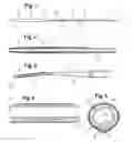 Fig. 02 - Delivery system for a prosthesis
