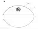 Fig. 01 - INTRAGASTRIC DEVICE