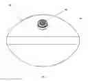 Fig. 02 - INTRAGASTRIC DEVICE