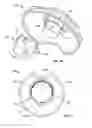 Fig. 06 - Brace having an inflation control