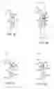 Fig. 02 - Orthopedic device including protruding members