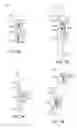 Fig. 03 - Orthopedic device including protruding members