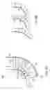 Fig. 06 - Orthopedic device including protruding members