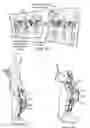 Fig. 10 - Orthopedic device including protruding members
