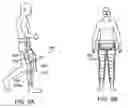 Fig. 11 - Orthopedic device including protruding members