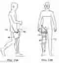 Fig. 14 - Orthopedic device including protruding members