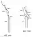 Fig. 15 - Orthopedic device including protruding members