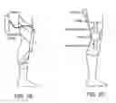 Fig. 19 - Orthopedic device including protruding members