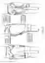 Fig. 26 - Orthopedic device including protruding members