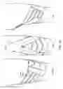Fig. 30 - Orthopedic device including protruding members