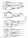 Fig. 31 - Orthopedic device including protruding members