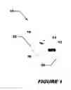 Fig. 02 - METHOD AND APPARATUS FOR INDUCING MICTURITION